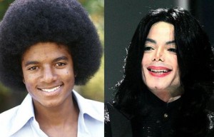 michael-jackson-plastic-surgery_479x307